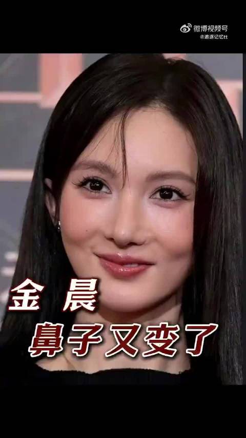 金晨驾车避让流浪犬失控撞墙，助理顶包无骗保