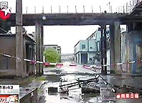 Selina拍戏三度烧伤需植皮