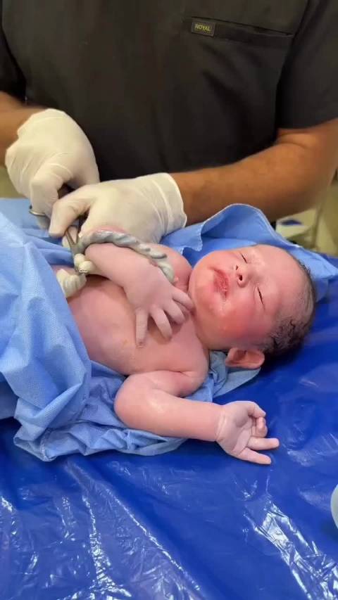 新生儿紧握脐带引关注，分娩瞬间画面曝光