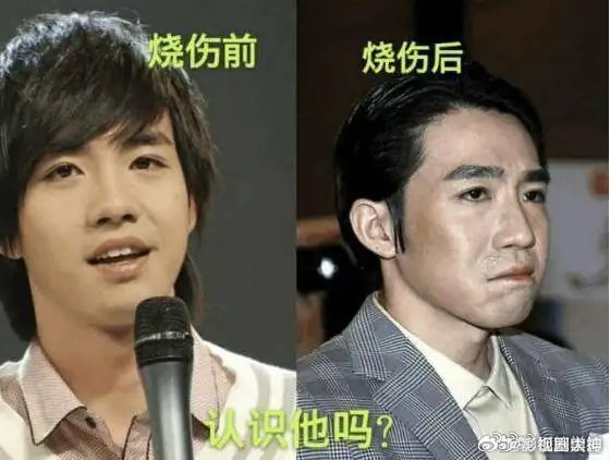 俞灏明15年后谈大火：那场火锻造了真正的我