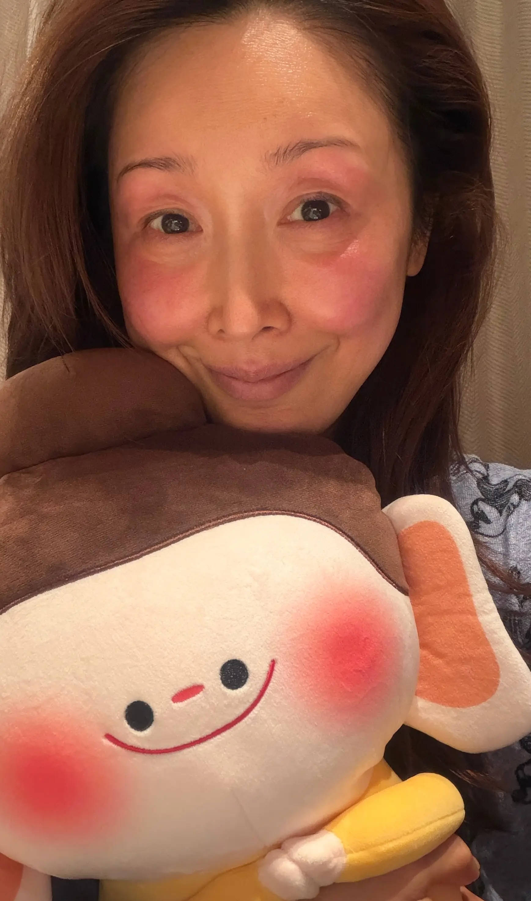 孙悦自曝录节目被冻伤：山西大同录春晚，冻伤冻成佛小伴