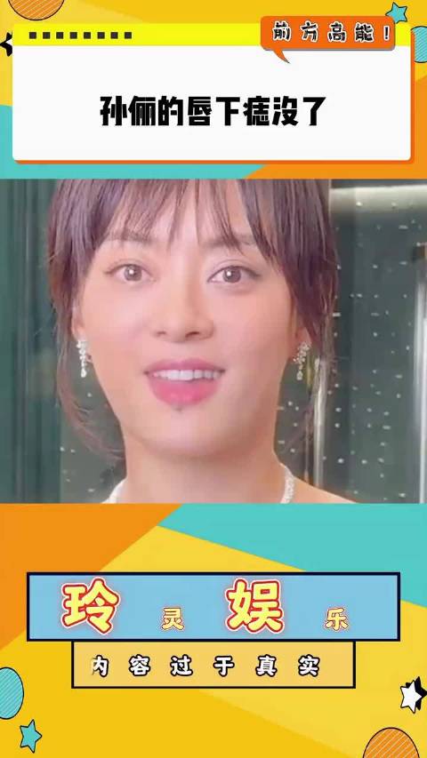 孙俪下巴上的痣没了