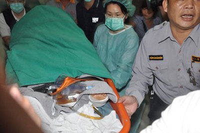 俞灏明确诊深二度灼伤Selina已经完成清创手术