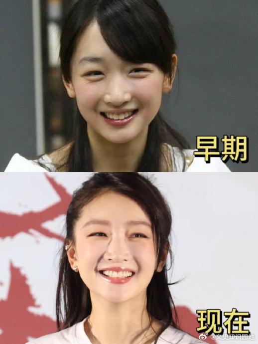 为什么周冬雨因容貌变化频繁引发公众讨论？