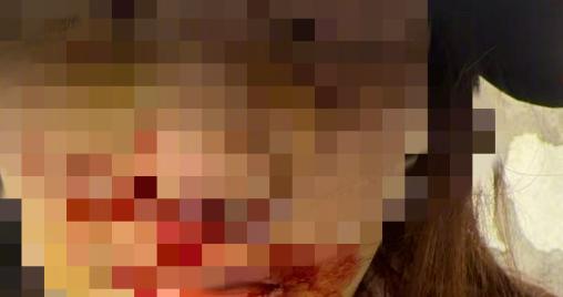 演员金晨交通事故处罚结果公开：罚款1500元，造成致人轻微伤或者财产损失的交通事故后逃逸，尚不构成犯罪