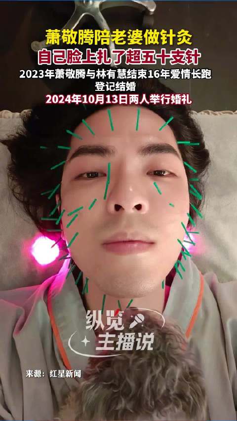 萧敬腾陪老婆做针灸自己扎满脸