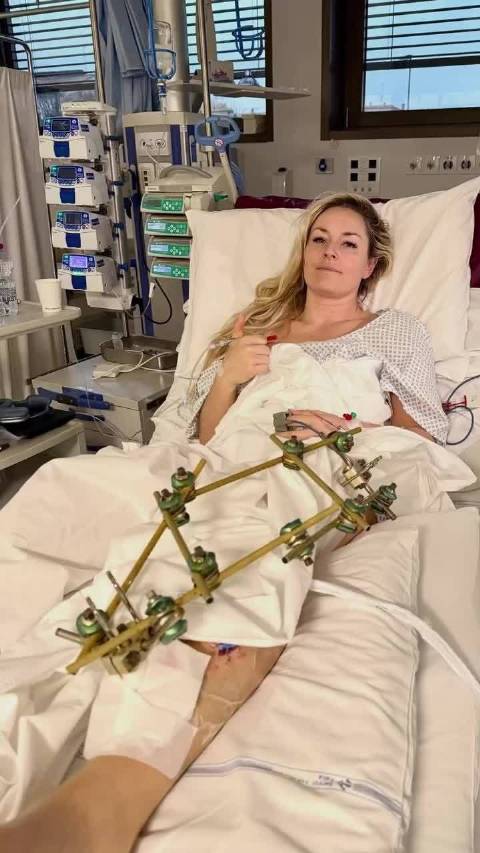 网坛众星祝福术后林赛沃恩，80次世界冠军诠释奥运精神