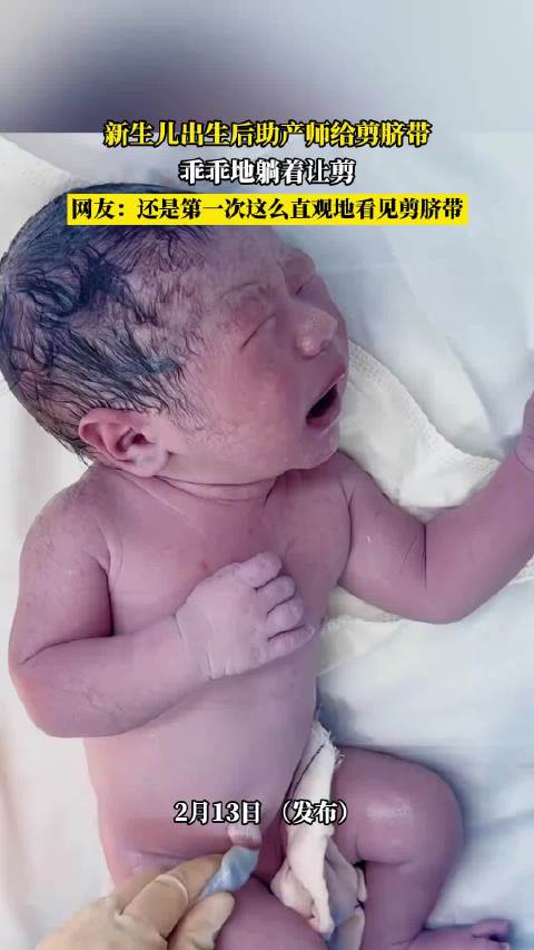 新生儿安静配合剪脐带过程引网友惊叹