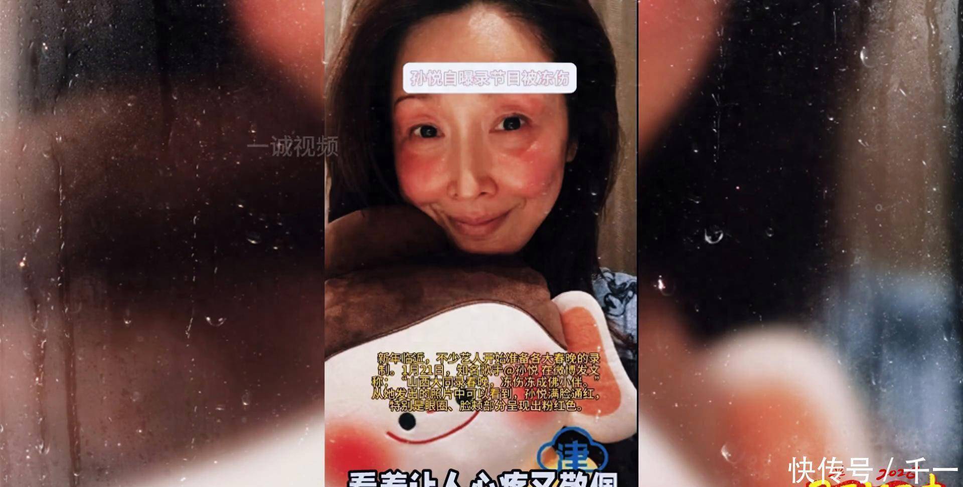 孙悦春晚户外录制冻伤脸颊，折射行业寒冬工作现状