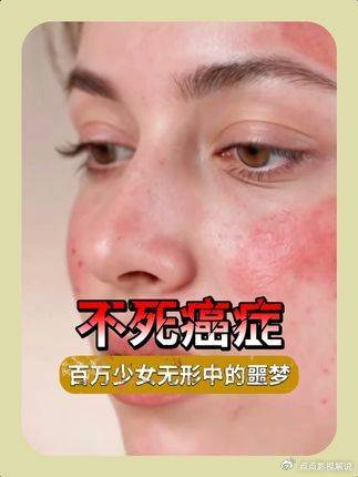 豪斯医生：它骗过所有医生，却让患者绝望：什么是『不死癌症』？