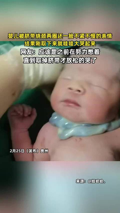 婴儿脐带绕颈两圈取下后大哭，网友称其之前憋着