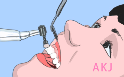 潔牙後牙齒敏感如何緩解？福田區王琦門診潔牙項目預約流程