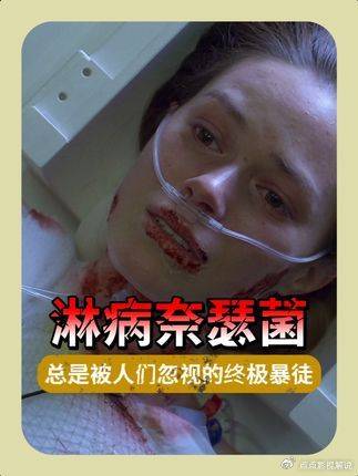 豪斯医生：一次疏忽引发百万分之一难题，就这？没事吧！