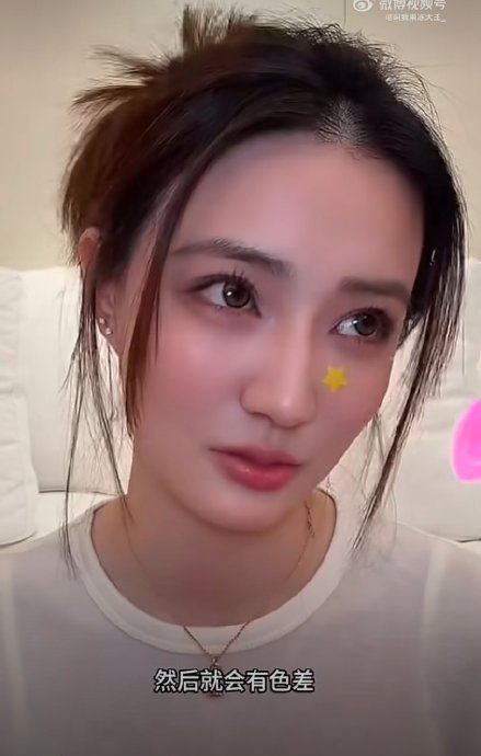 做了牙贴片后，徐璐在日常生活和饮食上遇到了哪些不便？