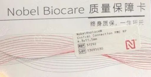 终身质保是什么意思