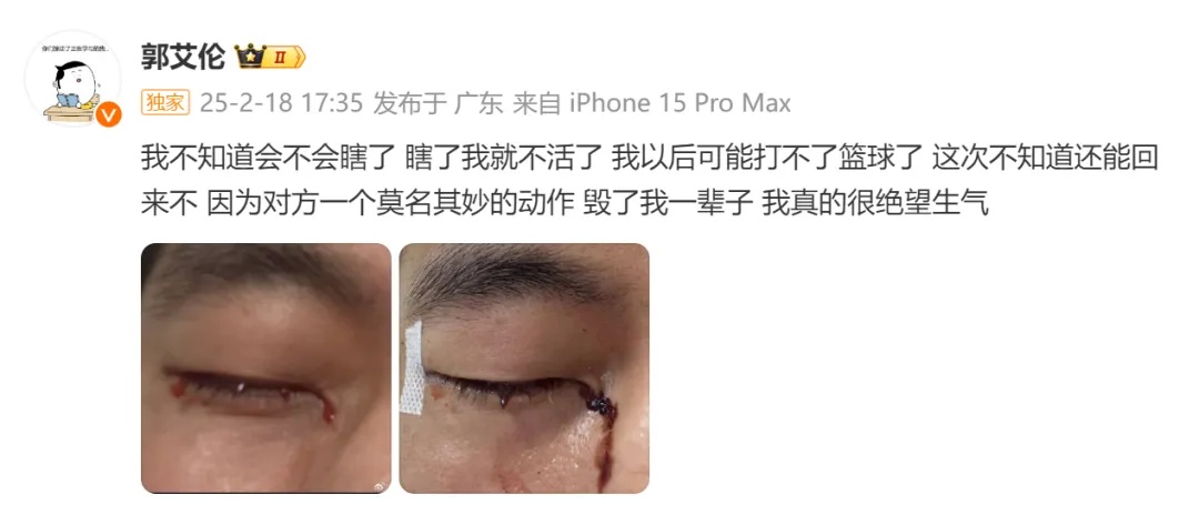 广州龙狮篮球俱乐部回应郭艾伦伤情!