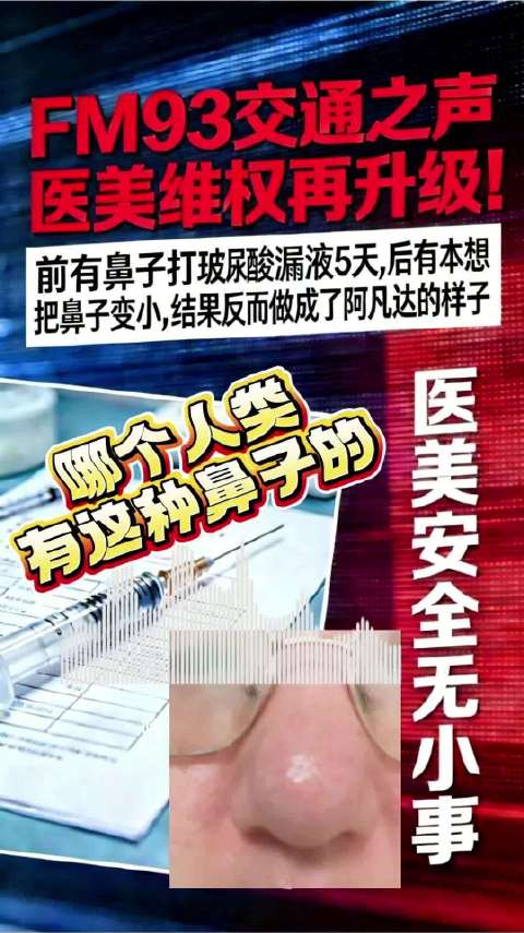 杭州女子花1万缩鼻变阿凡达半年漏液