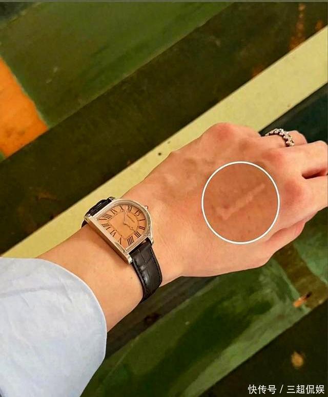 两年了,白敬亭手上的印记,还带着顾九思的温度