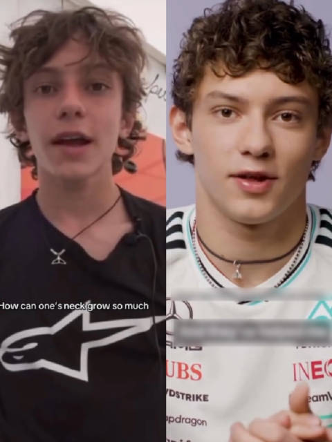 F1赛车手强健脖子引关注