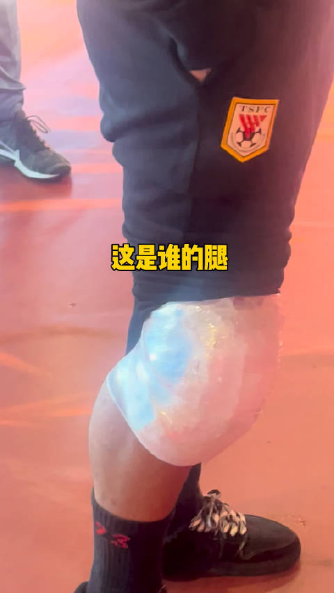 山东泰山队与北京国安大战后这是谁的腿猜猜