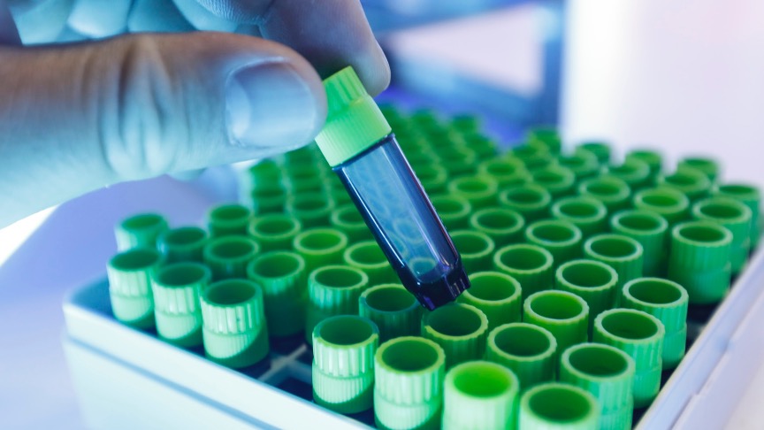 抖音小紅書刷量揭秘：真的有用嗎？