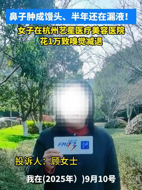 女子花1万打玻尿酸缩鼻变阿凡达