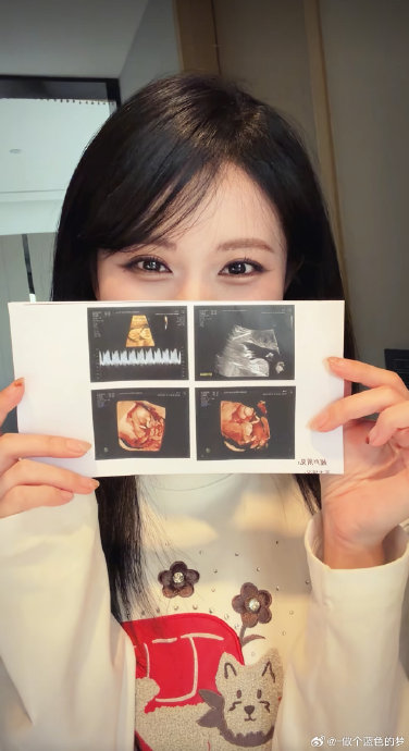 见证爱情长跑！网红情侣冬冬和37官宣怀孕，粉丝直呼圆满