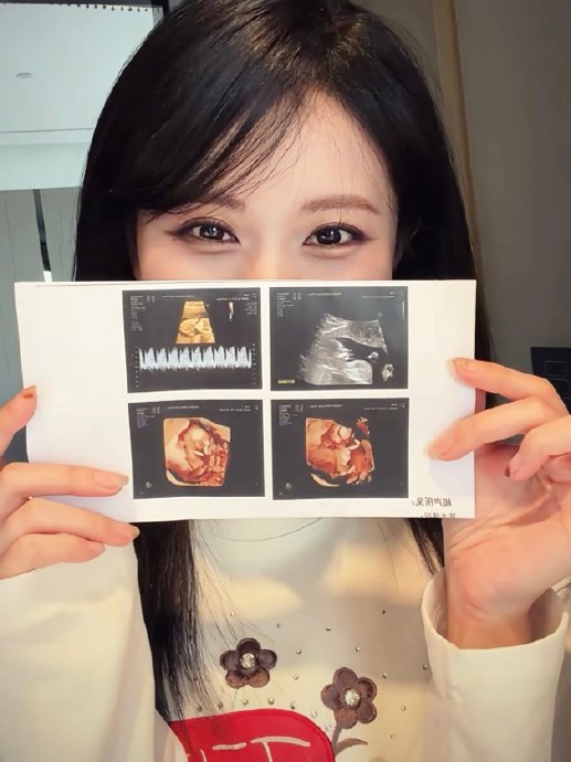 千万情侣博主官宣怀孕！七年长跑得“图图”，B超神似奥特曼