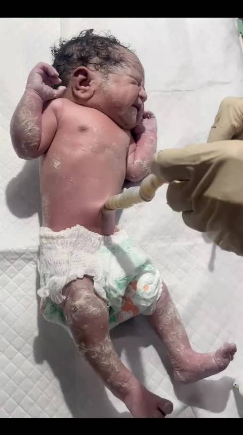新生儿剪脐带，你肯定没看过！