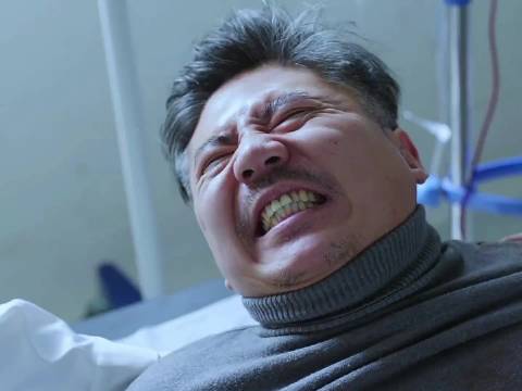 男子疑腹中有猫要求剖腹手术