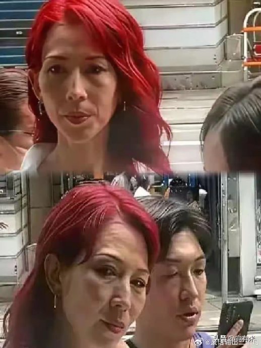 张晋的心脏病手术是如何进行的？