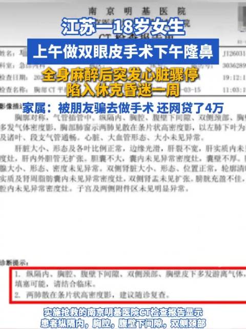 18岁女生隆鼻麻醉突发心脏骤停休克 经过一周的救治，已苏醒但意识仍模糊无法开口说话