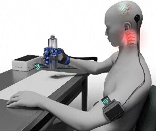 2026年3月13日，全球首个植入式脑机接口三类医疗器械获批上市，患者可凭借意念控制气动手套实现抓握。上海市科委资料图