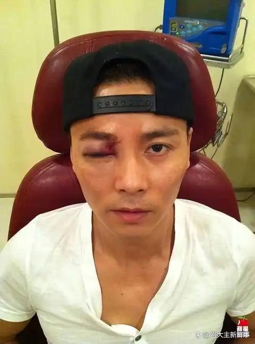 张晋新加坡旅行突发心脏病,蔡少芬曝血管堵塞近80%