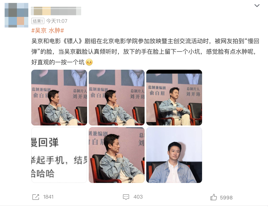 吴京戳脸“一按一个坑”冲上热搜!水肿位置不同,可能暗示这几种病