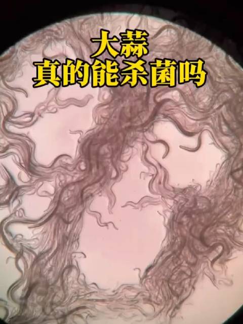 显微镜实验验证蒜汁快速杀灭寄生虫,揭秘关键成分与科学吃法