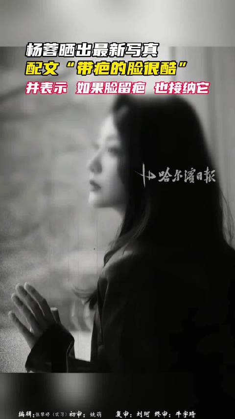 杨蓉称脸被自己烫伤留疤