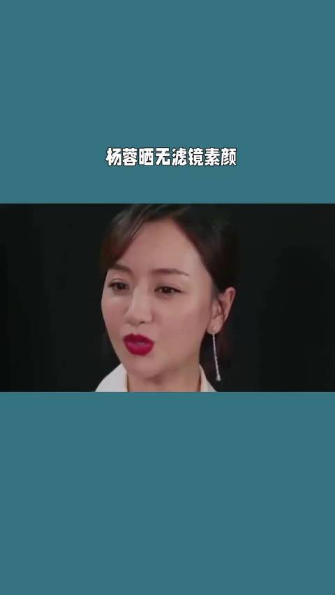 杨蓉晒烫伤恢复照，称带疤的脸很酷