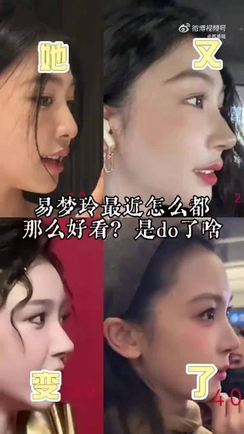整容咋了啊，女孩子不可以爱美吗？况且整容又不犯fa， 人家本来也长的很漂亮