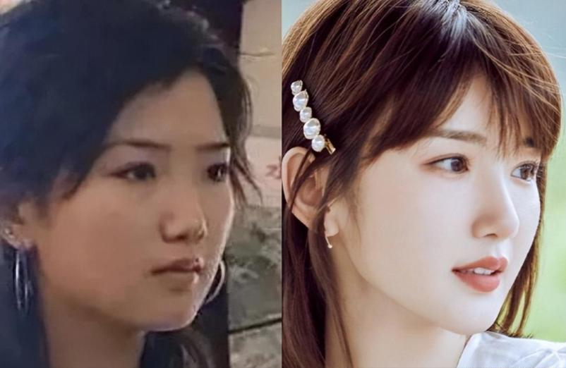毛晓彤否认医美：对比7位“当红花”的出道照，是否do脸一目了然