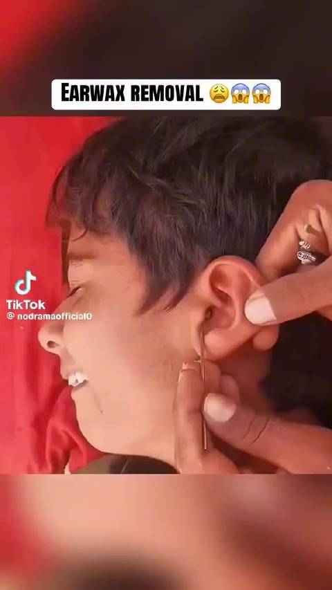 这就是为什么他听不见了