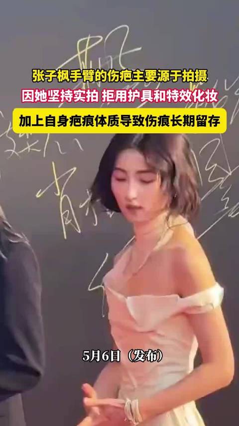 张子枫拍摄拒用护具留疤痕