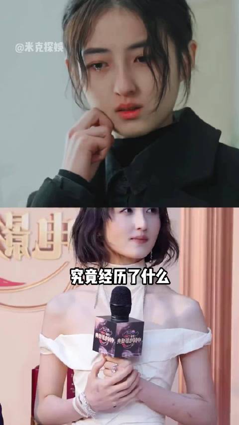 张子枫手臂伤疤曝光，一道疤一部戏见证敬业精神