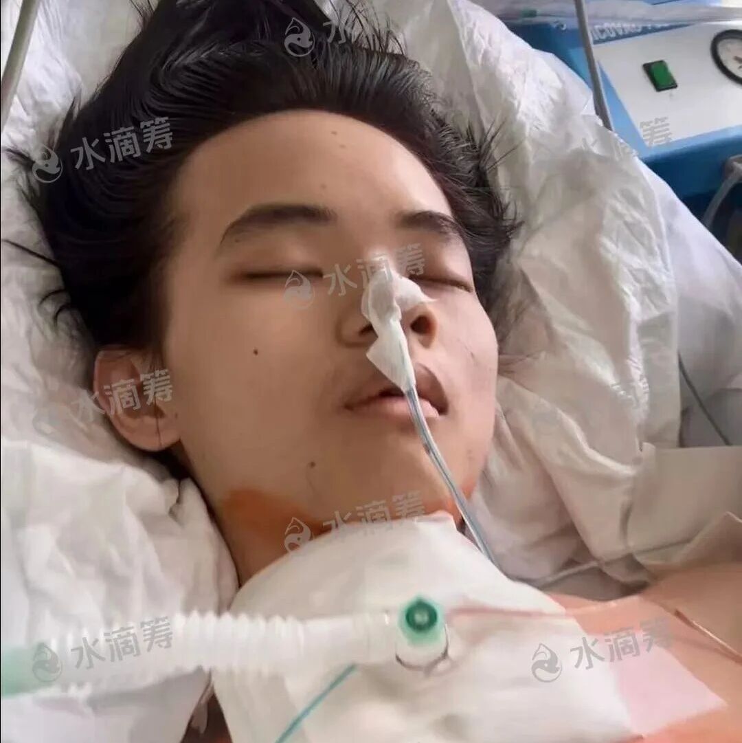 【求助】澄海20岁留俄学子突发重病昏迷不醒，农村母亲跨国陪护，急需救命钱！
