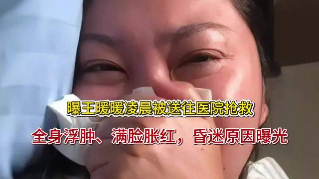 曝王暖暖凌晨被送往医院抢救！全身浮肿、满脸胀红，昏迷原因曝光