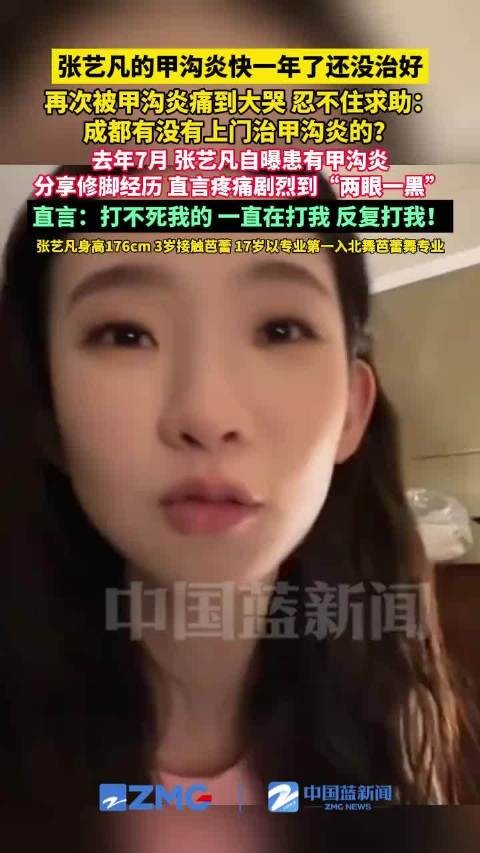 张艺凡的甲沟炎快一年了还没治好 - 爱乐趣生活