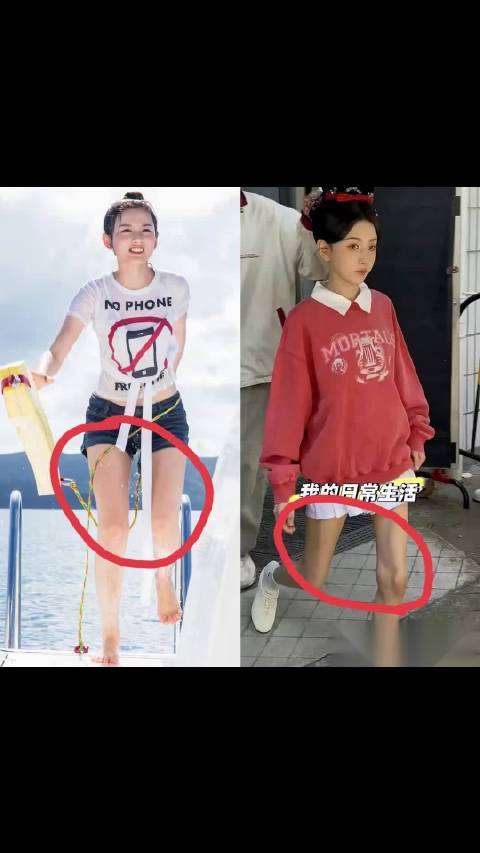 宋祖儿妈妈谈女儿暴瘦担忧