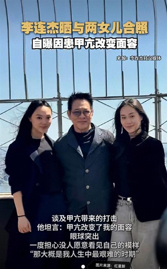 63岁李连杰直面甲亢:容貌被改变，却活成了最清醒的模样_新闻