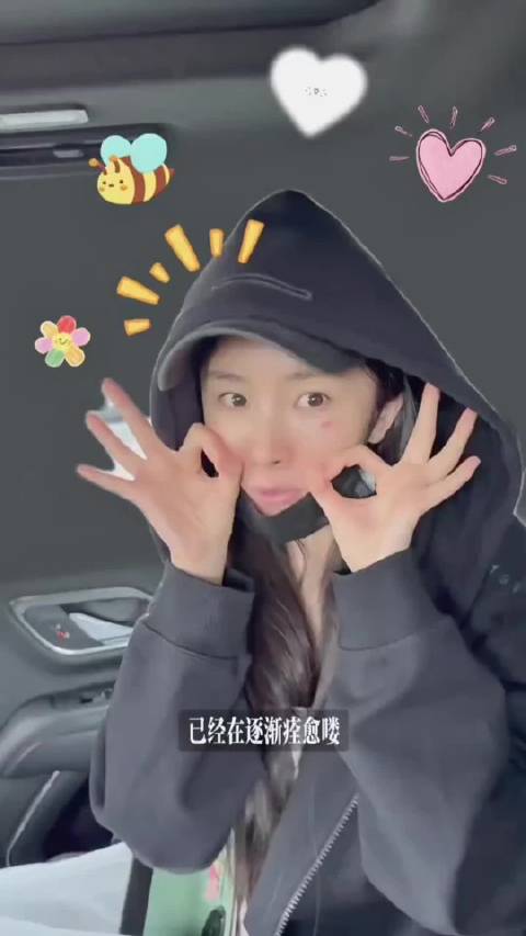 杨幂素颜出镜自曝烫伤，右颊红印清晰可见
