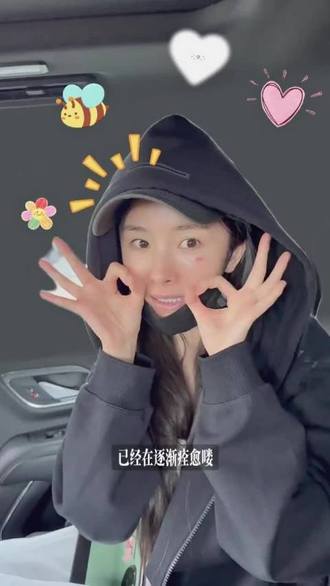 杨幂烫伤意外与角色命运共振